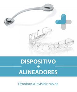 Odontokids_Málaga_expertos_en_resolver_los_casos_de_ortodoncia_más_complicados